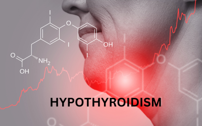 Hypothyroidism CME