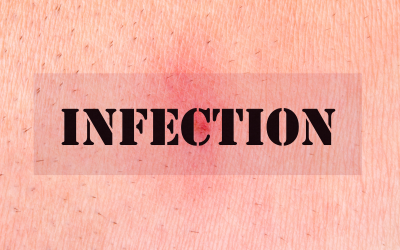 Infections of the Skin CME
