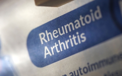 Rheumatoid Athritis CME