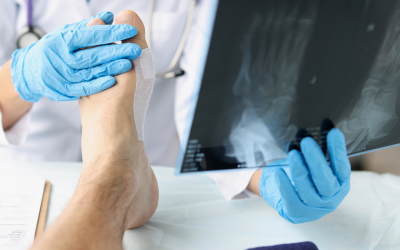 Diagnosis and Assessment of Foot and Ankle CME