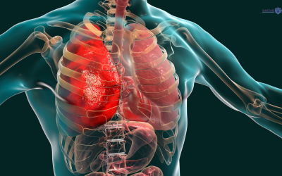 Pulmonary Rehabilitation CME Series CME